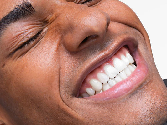 5 Interesting Teeth Whitening Facts