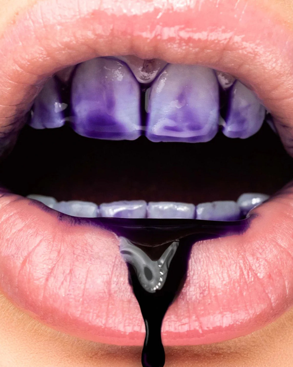 Gel de albire a dinților.